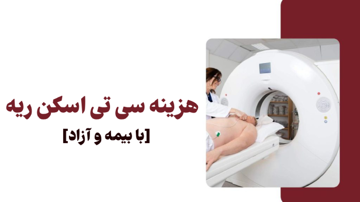 هزینه سی تی اسکن ریه [با بیمه و آزاد]