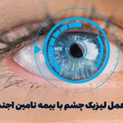 هزینه عمل لیزیک چشم با بیمه تامین اجتماعی