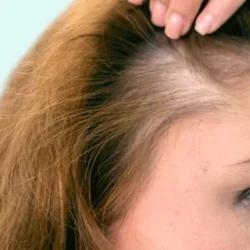 قطع ریزش مو، افزایش رشد و درخشندگی