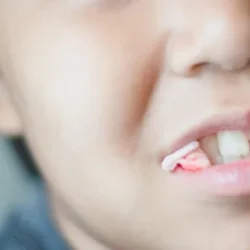 قطع فوری خونریزی دندان بعد از کشیدن: راهنمای سریع و علمی