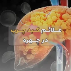 علائم کبد چرب در چهره ( لیست کامل نشانه هایی که باید جدی بگیرید )