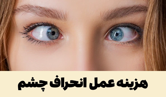 هزینه عمل انحراف چشم [با لیزر، با بیمه تامین اجتماعی، در بیمارستان]
