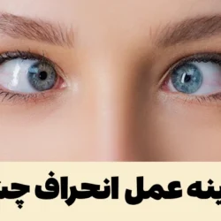 هزینه عمل انحراف چشم [با لیزر، با بیمه تامین اجتماعی، در بیمارستان]