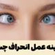 هزینه عمل انحراف چشم [با لیزر، با بیمه تامین اجتماعی، در بیمارستان]