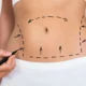 پیکرتراشی چیست و چه کسانی کاندید مناسبی هستند؟
