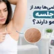 چرا بعضی‌ها بعد از ده جلسه هنوز مو دارند؟